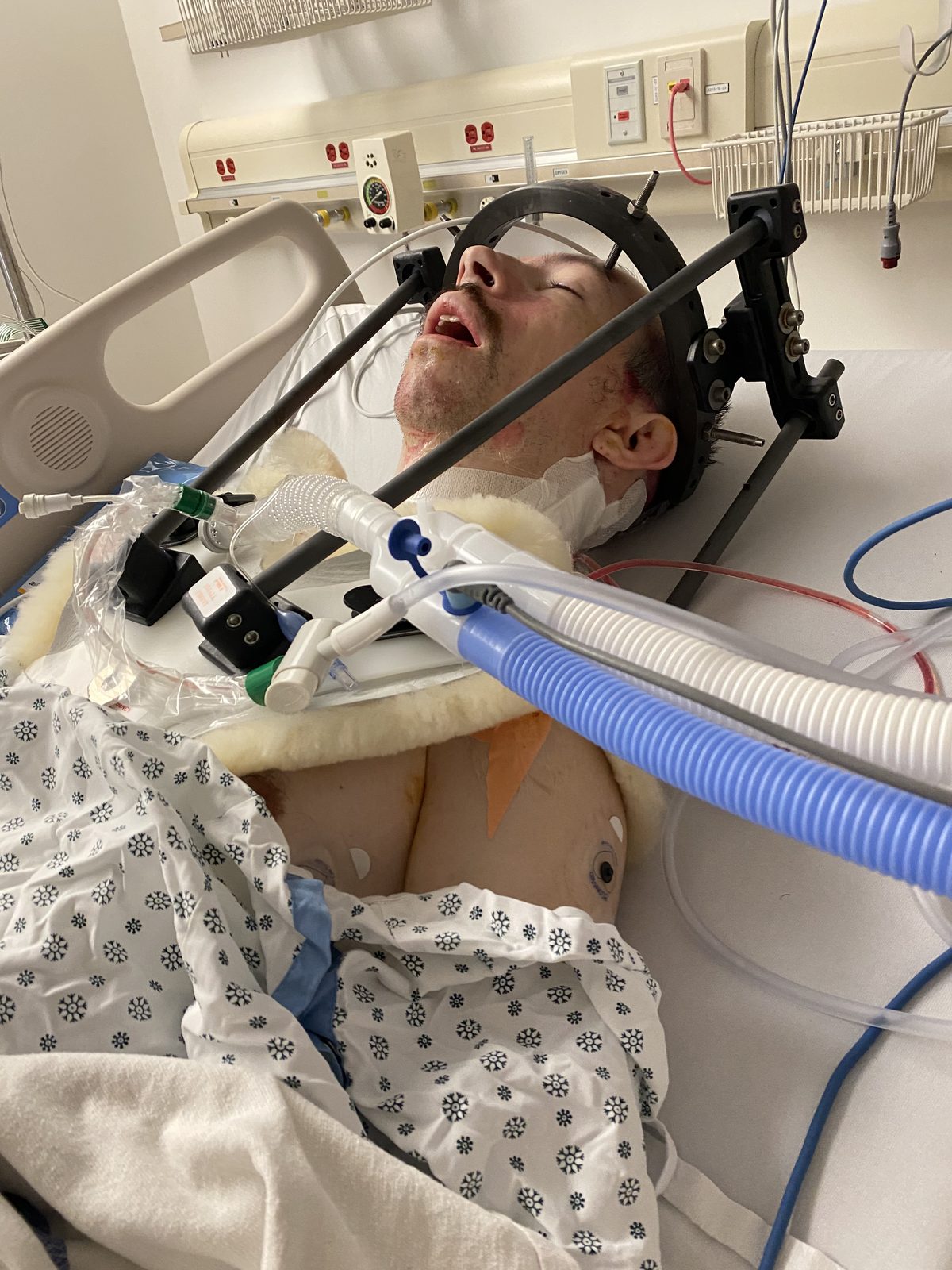 After surgery.