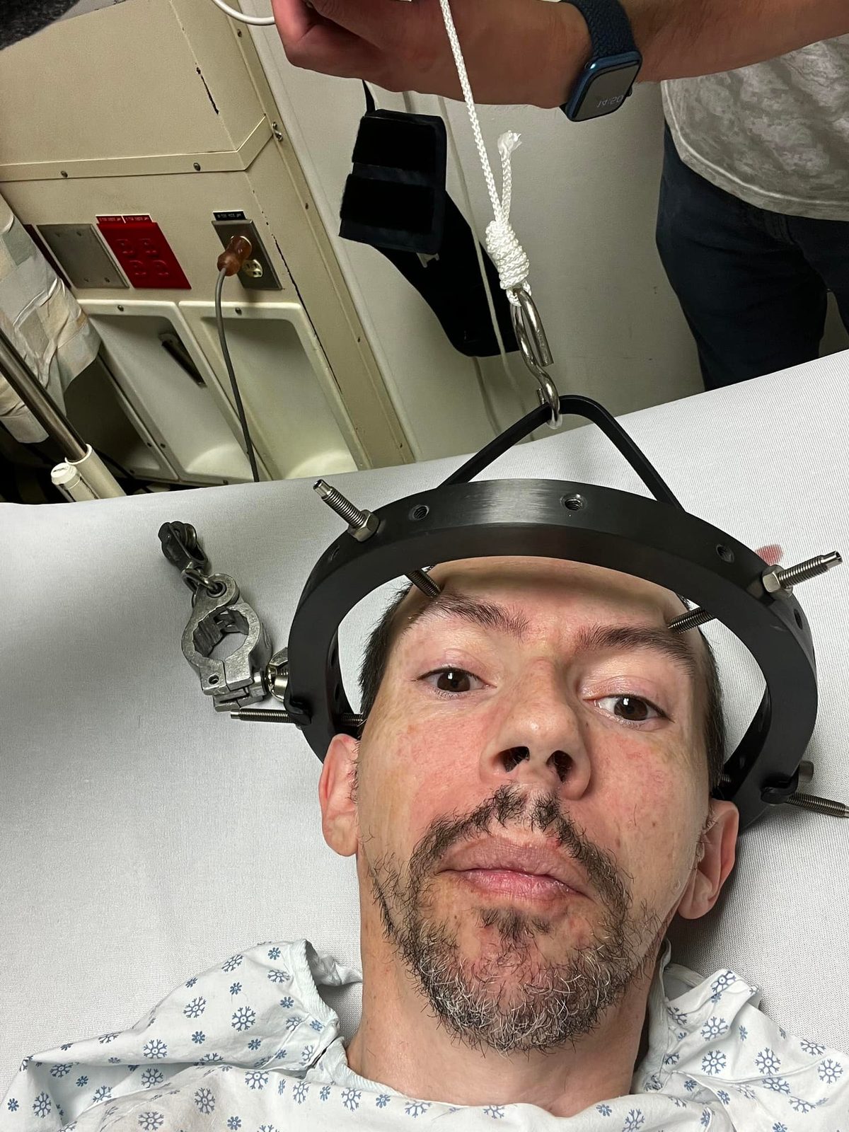 Thomas in the halo brace