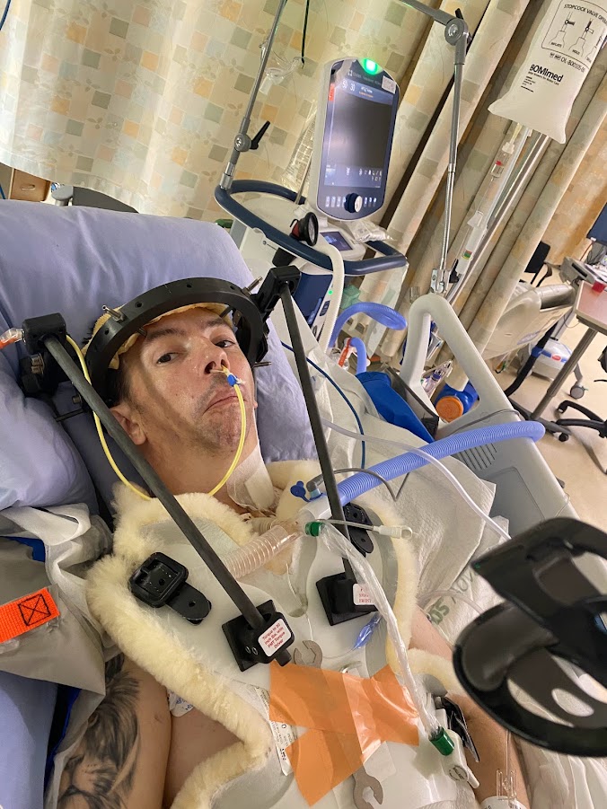 In a halo brace after cervical spinal fusion, July 2022